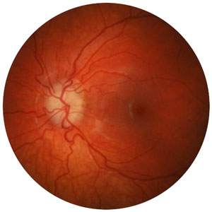 Image Eye Health